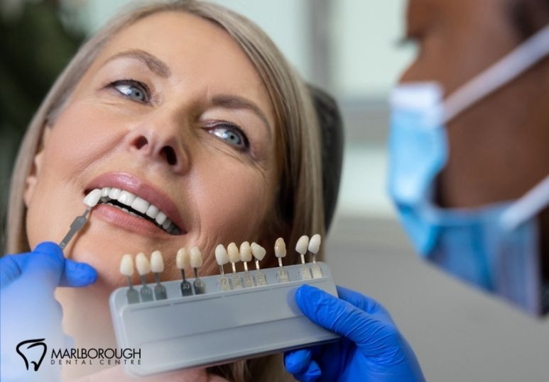 How Porcelain Veneers Can Instantly Transform Your Smile
